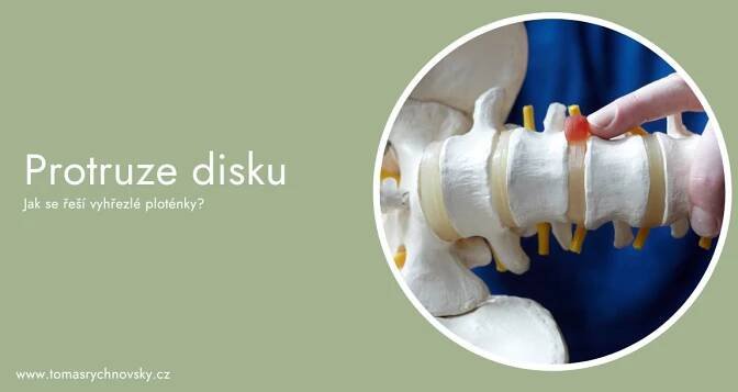 Protruze disku: Jak se řeší vyhřezlé ploténky?