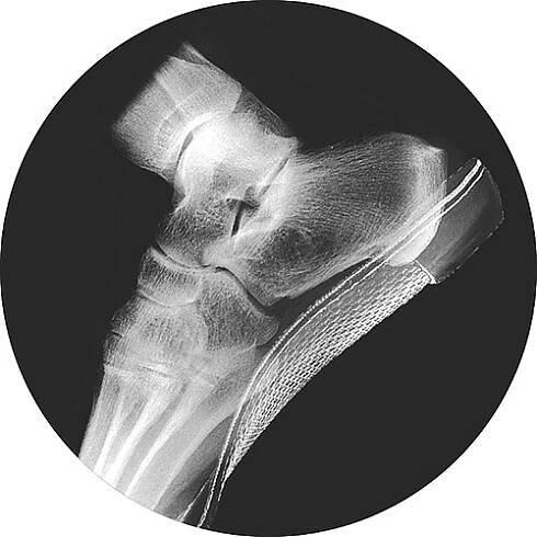 ABOUT - Northwest Podiatric