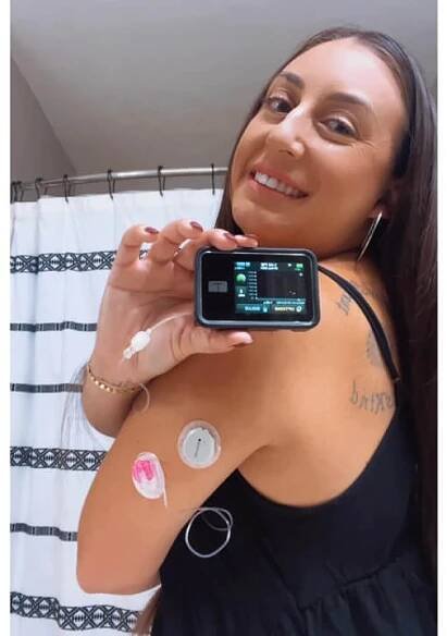 Misdiagnosed with Type 2 Diabetes: Megan's Journey to a Type 1 Diagnosis