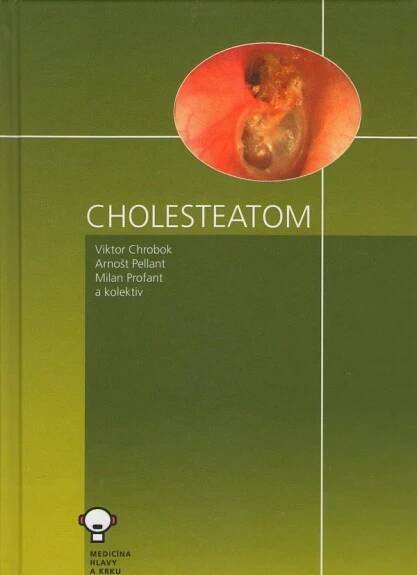 Cholesteatom - výprodej – tobias-ucebnice.cz
