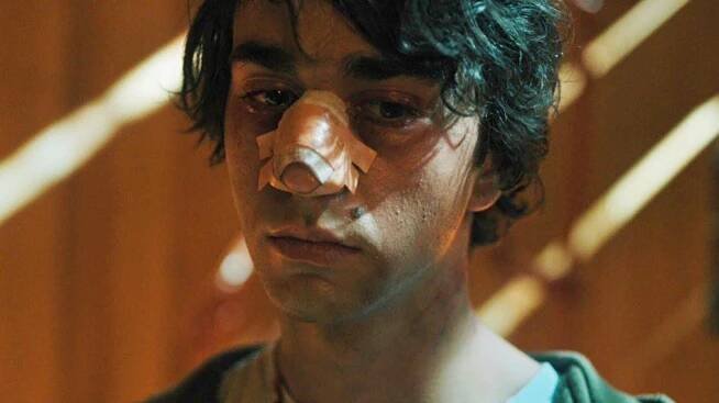 Actors Who Developed Scary Phobias And Medical Conditions While Filming TV Shows And Movies