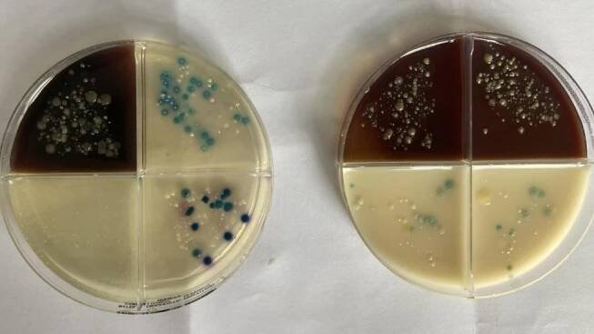 6 tipů k omezení přenosu Staphylococcus aureus v chovu - Agropress.cz