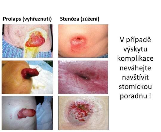Uherskohradišťská nemocnice a.s. - Stomická ambulance