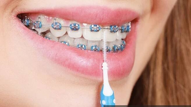 Dentální hygiena s rovnátky, Praha, Kamýk, Dentální hygiena NAŠE ZUBY - Mgr. Monika Mrzenová DiS.