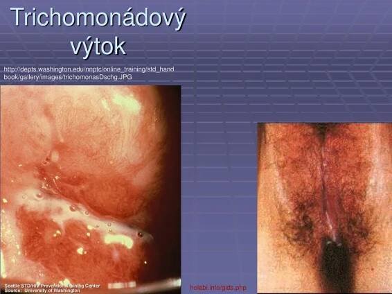 PPT - Lékařská mikrobiologie pro ZDRL PowerPoint Presentation, free download - ID:6149225