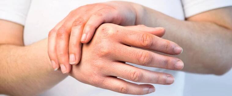 AD_IRRITATIONS_RED-HANDS_LARGE_2021