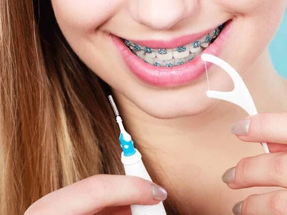 Flossing with Braces and Why It’s Important