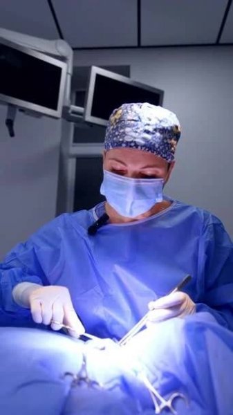 Doktor používá kovové nástroje a šije pacientovi nitě. Poslední fáze operace. Svislé video. — Stock záběr