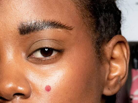 Here's Exactly How to Get Rid of a Pimple Overnight