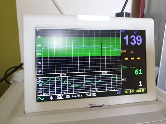 CTG (monitor, pásy, ozvy, kardiotokografie) – kdy, jak a proč? - Modrý koník