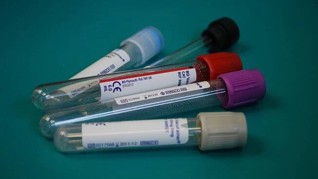 Infekci hepatitidy C šíří desítky tisíc Čechů – faei.cz