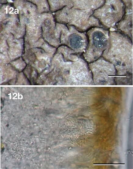 Neoprotoparmelia plurisporibadia