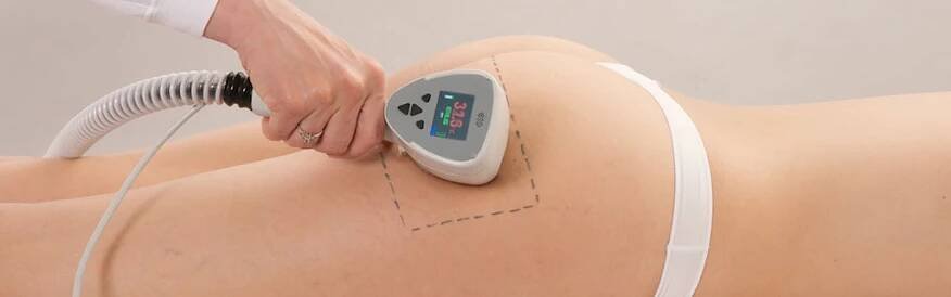 Liposukce Exilis Ostrava