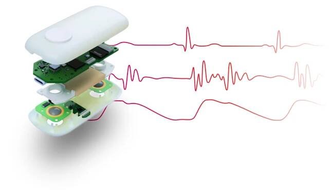Senzor CardioTag spracúva 3 signály - elektrokardiogram, seizmokardiogram a pletyzmogram. Kredit: CARDIOSENSE.