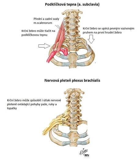 Krční žebro - anatomické poměry