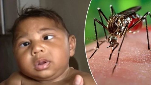 Virolog: Zika dělá dětem to, co zarděnky. Takový virus tu nebyl přes 50 let