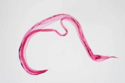 whipworm (trichuris trichiura) je parazitická helmintická nematoda (kulat�á) pod mikroskopickým pohledem pro vzdělávání - motolice ploštěnci - stock snímky, obrázky a fotky