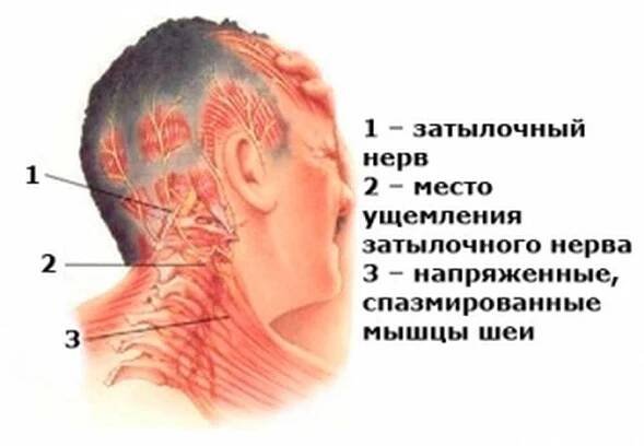 Symptomy osteochondrózy, které jsou užívány pro jiné nežádoucí příhody / Články | Užitečné informace a tipy na péči o sebe
