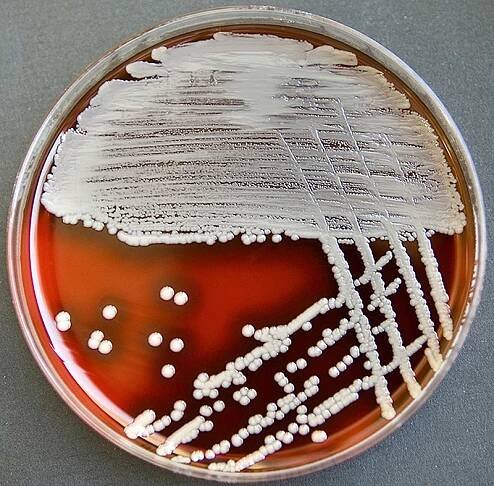 Cellulitis