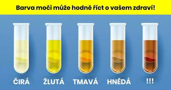 Barva moči může hodně říct o vašem zdraví: Zkontrolujte se doma, zda jste v pořádku - tohle vám může zachránit život!
