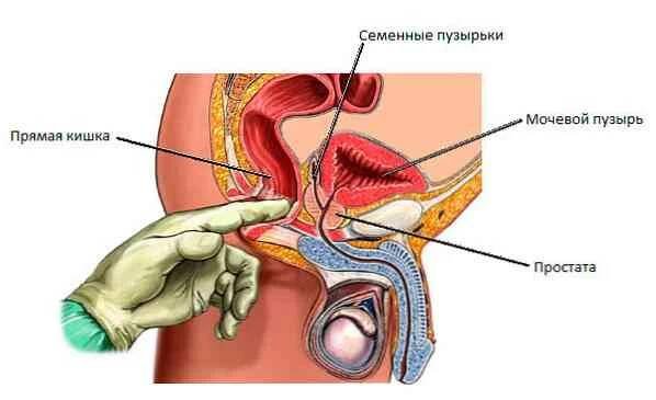Anal polyp příčiny, příznaky, léčba / Proktologie | Užitečné informace a tipy na péči o sebe. Zdraví, výživa a další.