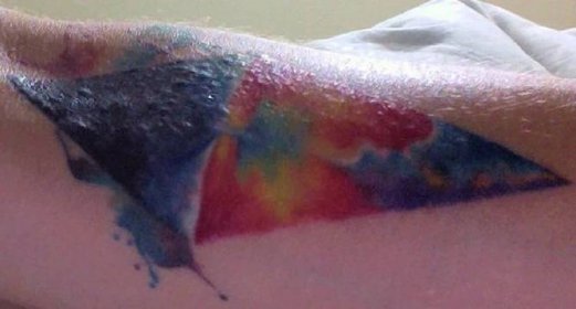 špatně vyléčený-tetovací kryt