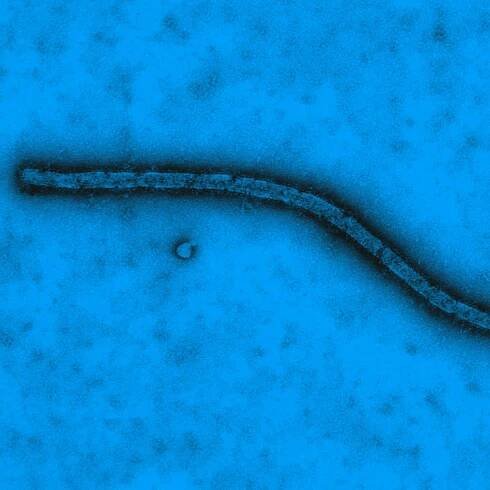 Virus Ebola vu en microscopie électronique à transmission - Institut Pasteur