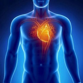 Ischemická choroba srdeční (ICHS)
