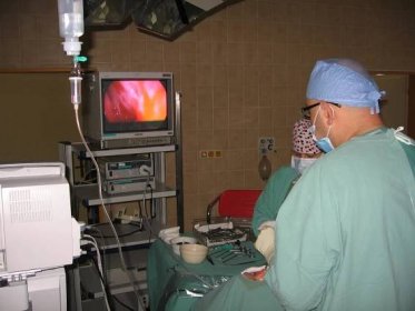 Endoskopické operace nosních dutin pro záněty a nosní polypy (FESS)