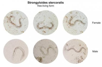 mikroskopický pohled koláž volně žijící formy mužské a samice strongyloides stercoralis v lidské stolici, patogenní parazitický threadworm způsobující onemocnění strongyloidiáza. - škrkavka - stock snímky, obrázky a fotky
