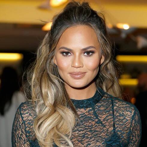 Chrissy Teigen's Fuller Lips Are an Allergic Reaction, Not Filler - Photos