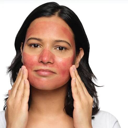 The Ordinary AHA 30% + BHA 2% Peeling Solution