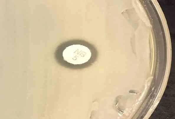 Vlastnosti Staphylococcus saprophyticus, taxonomie, morfologie, patogeneze / Biologie
