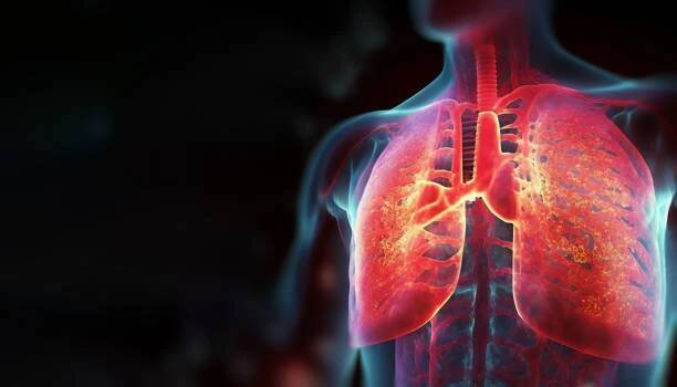 holografický koncept zobrazení rakoviny plic, onemocnění plic, léčba rakoviny plic, onemocnění plic, jako je pneumonie, virové infekce nebo rakovina - karcinom - stock snímky, obrázky a fotky