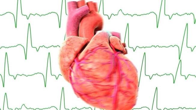 Neléčená srdeční arytmie může mít fatální následky
