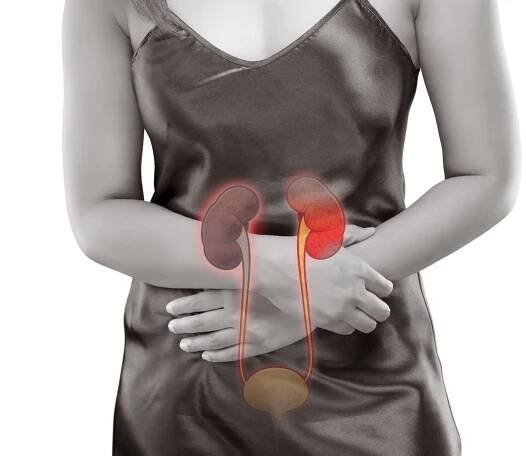 How is PCOS Diagnosed?