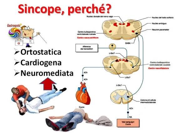 Il paziente che sviene, la sincope