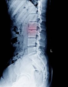 Conditions we treat - Frisco Spine