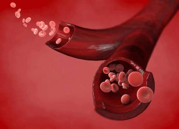 červené krvinky a průtok krve žílou, malé sférické buňky, které obsahují hemoglobin, protein, který dává krvi červenou barvu - blood clot lung - stock snímky, obrázky a fotky