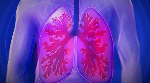 Je zápal plic nakažlivý? Faktory o kterých byste měli vědět