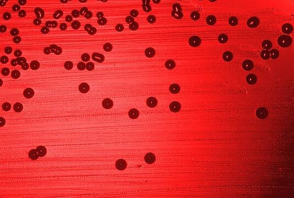 Gammaproteobacteria