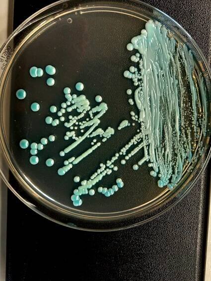 Obrázek - Candida albicans (kandida bělostná) | BioLib.cz
