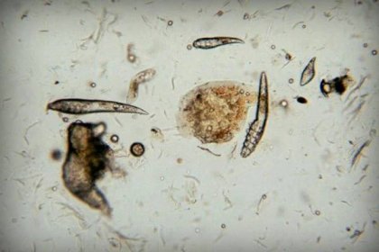 Vejce, larvy a roztoči v čočce mikroskopu