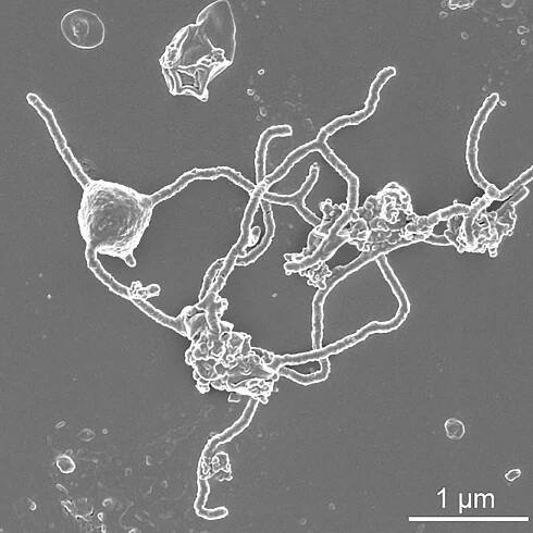 Asgard (archea)