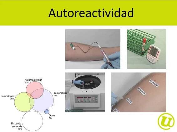 leccion para pacientes con urticaria