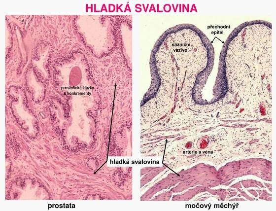 PPT - SVALOVÁ TKÁŇ, CHONDROGENNÍ A DESMOGENNÍ OSIFIKACE PowerPoint ...