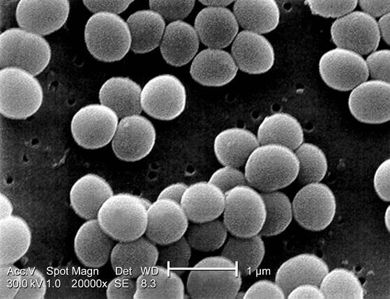 Bezplatný obrázek: Staphylococcus aureus, bakterie