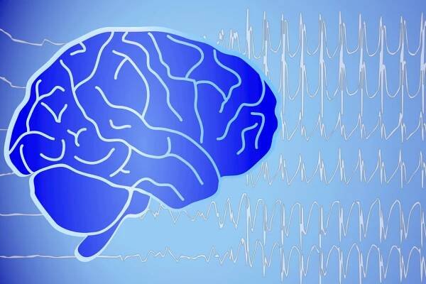 Diagnose einer Epilepsie - Anamnese, EEG & MRT