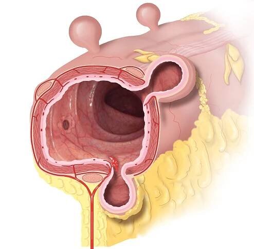 Chinaza – Artists' Blogs :: Medical Illustration Sourcebook