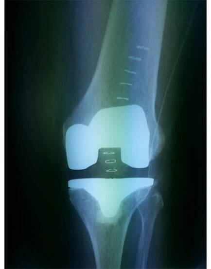 Joint line Orthopaedic Hospital